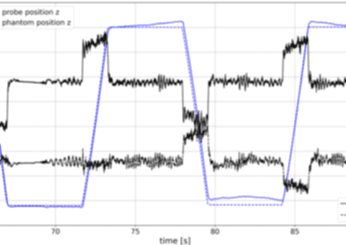 Graph showing data acquired during vertical motion of the phantom.